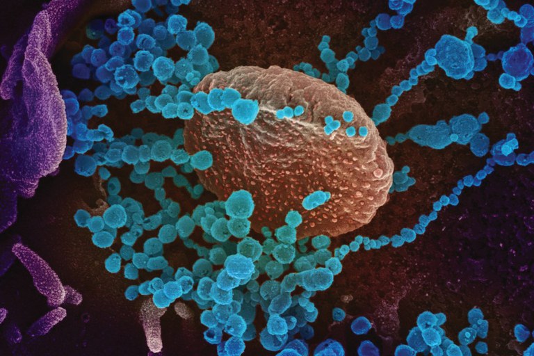 This scanning electron microscope image shows SARS-cov-2 (round blue objects) emerging from the surface of cells cultured in the lab. The virus shown was isolated from a patient in the U.S. Credit: Institute of Allergy and Infectious Diseases