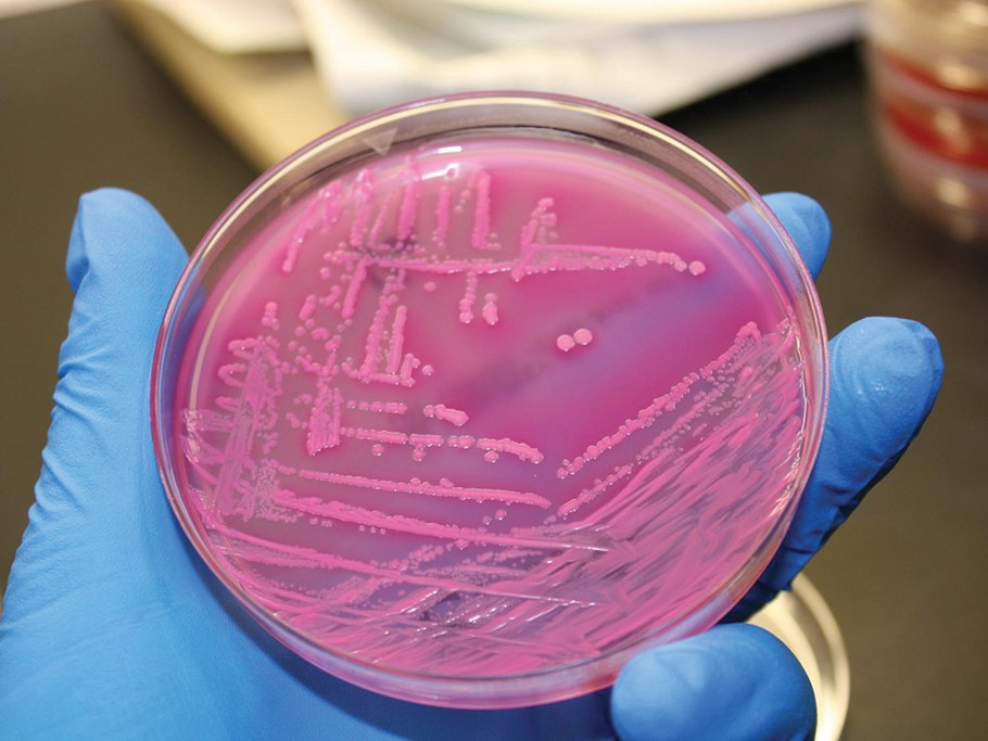 e.-coli-dish-veedunn-flickr.jpg